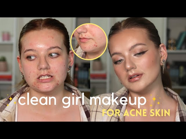 *in depth* CLEAN GIRL makeup tutorial for acne/textured/scarred skin