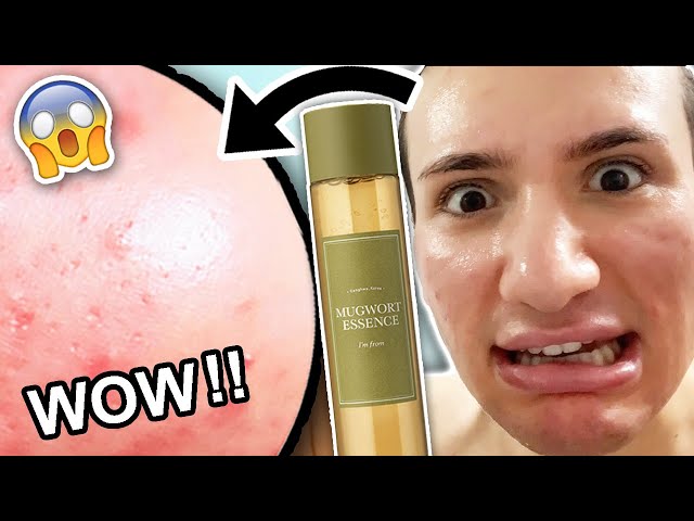 I tried the I'm from MUGWORT ESSENCE for ONE WEEK! 🌿 REVIEW || Amazing for ACNE?