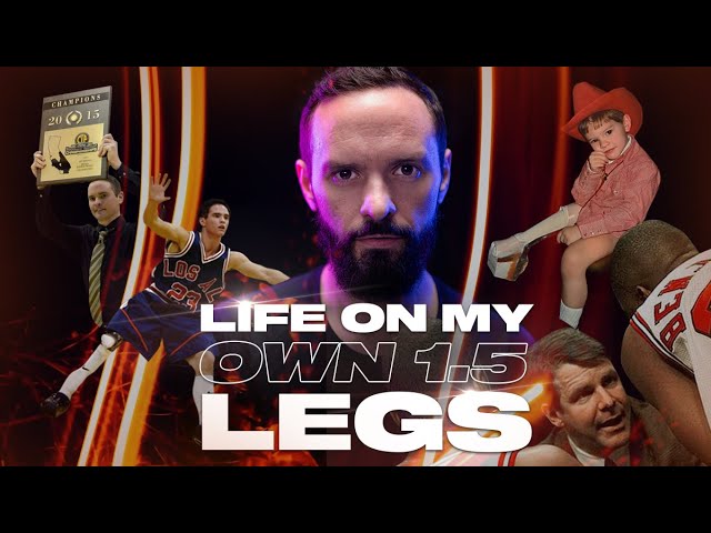 LIFE ON MY OWN 1.5 LEGS | MY STORY