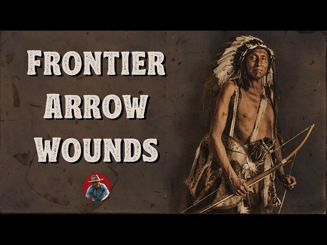 5 Brutal Lessons from Frontier Arrow Wounds