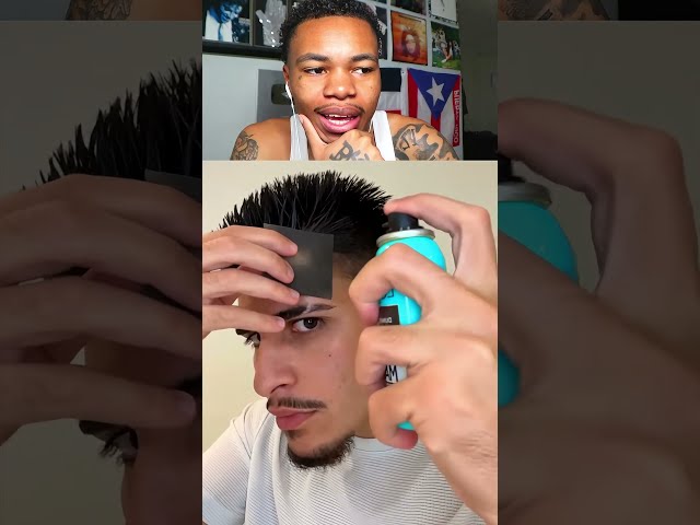 He Fixed his Hairline in 2 seconds