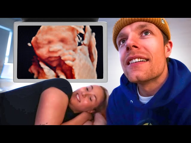 DIT IS HOE ONZE KLEINE ERUIT ZIET!😍 | baby vlog #8