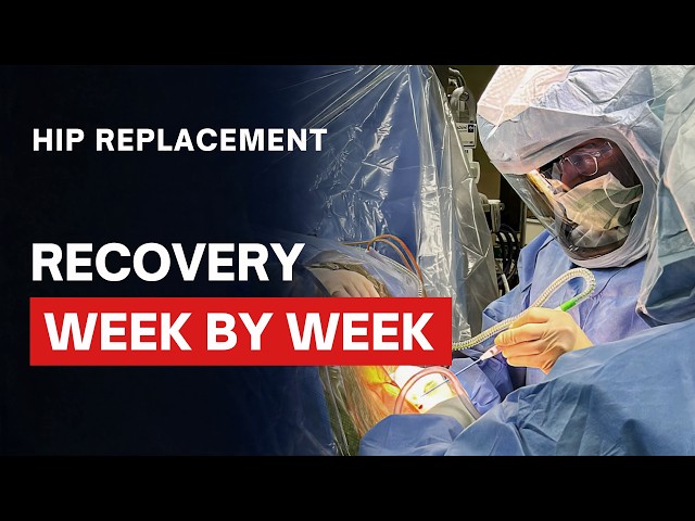 Hip Surgery Recovery: Everything You Need to Know Week-by-Week