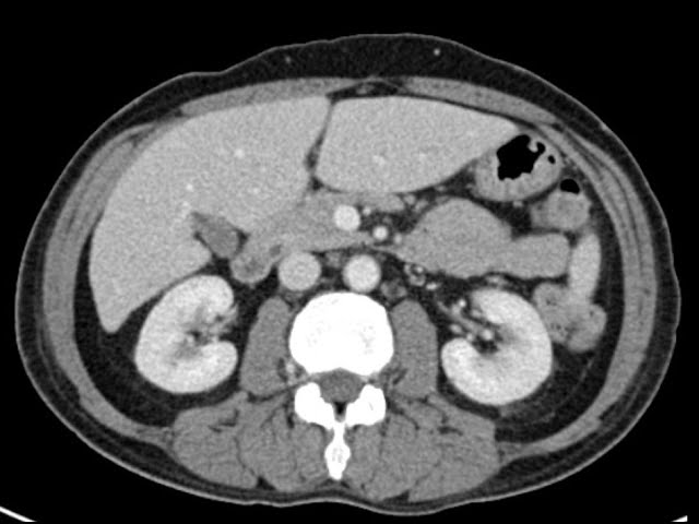 Anatomy of CT scans: Abdomen
