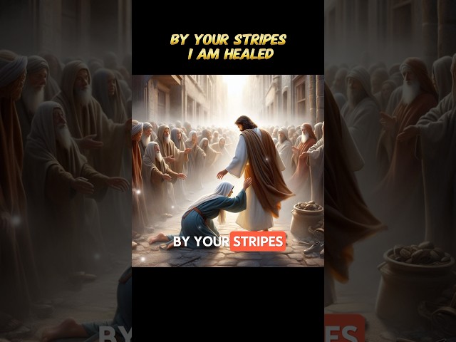 By Your Stripes I Am Healed-(Isaiah 53:5)