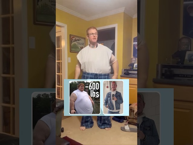 Checking in with Casey (previously 835 lbs) after his body lift