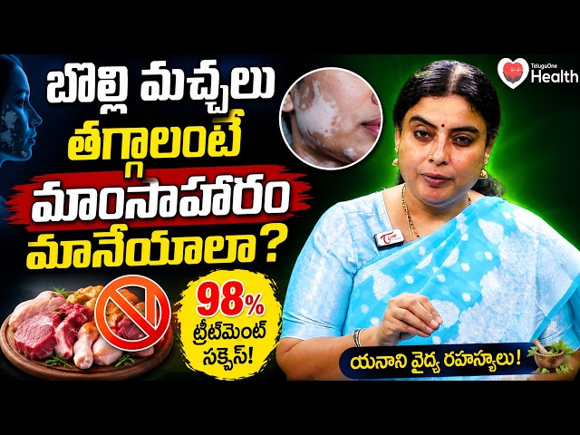 Vitiligo | బొల్లి మచ్చలు తగ్గాలంటే మాంసాహారం మానేయాలా? | Dermatology | Dr. SGV Satya | ToneHealth
