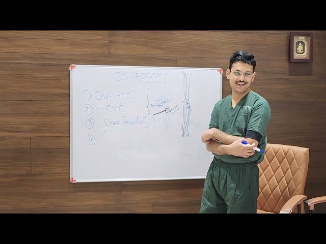 Tibial Osteotomies : Class for Orthopedic Surgeons