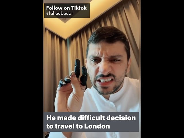 Deep frostbite. A Qatari mountaineer lost his fingers due to frostbite while climbing a mountain.