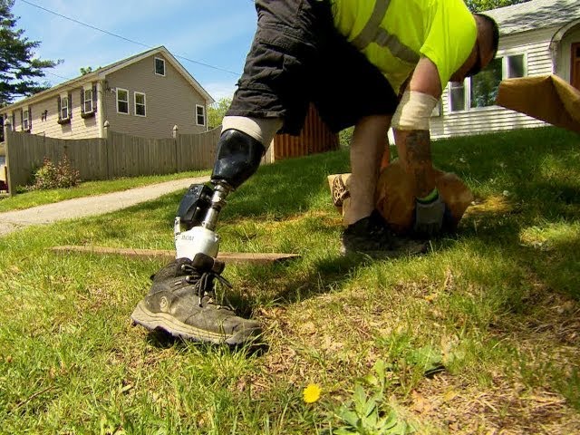 CBS Evening News with Scott Pelley - Bionic limbs giving new life to amputees
