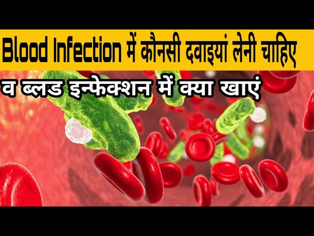 Blood Infection Explained | Medicines and Diet for Blood Infection | Knowledge TV