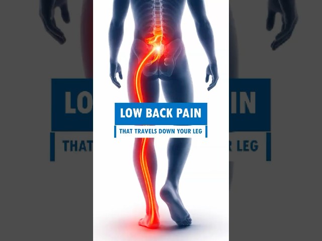 Lower Back Pain That Travels Down Your Leg #shorts