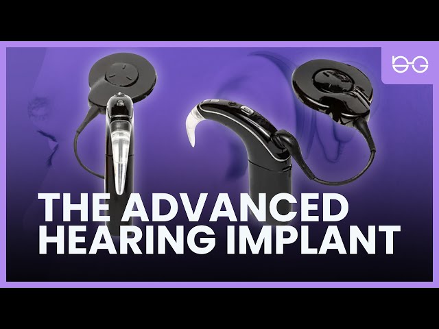 Bionic Ears: Hearing Implant