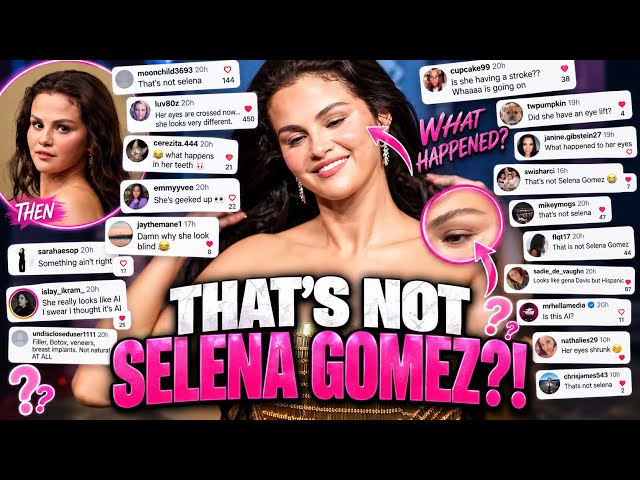 Selena Gomez Emmys Red Carpet BACKLASH! CLONE? 