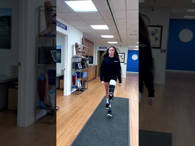 Devan, Rotationplasty Amputee Walking with a prosthesis