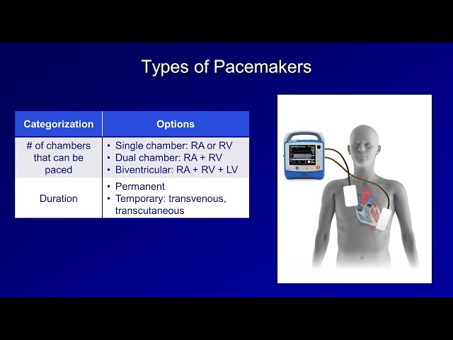 An Introduction to Pacemakers