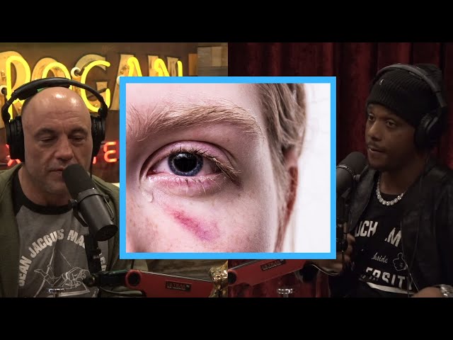 This Sport Has A Huge Problem with Eye Injuries