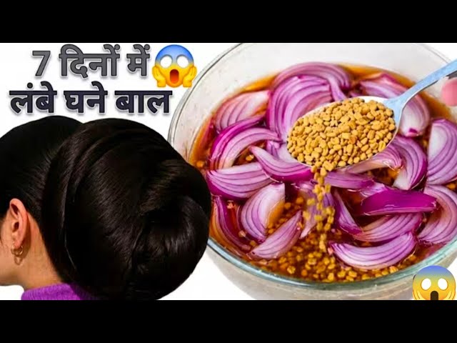 प्याज को इस तरह अपने बालों में लगालो बाल इतने लंबे और घने हो जाएंगे 💯_की कटवाने की नौबत आ जाएगी 