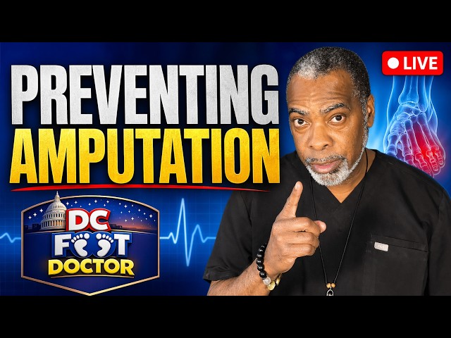 Preventing Amputation