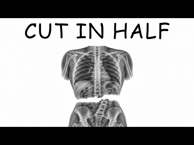 What Getting Cut in Half Feels Like