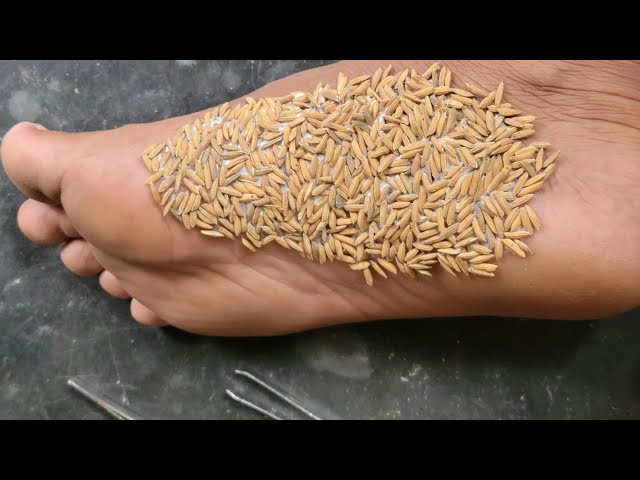 Satisfying Seed Peel | Seed Peeling ASMR | Peeling Glued Seeds | Relaxing Seed Removal