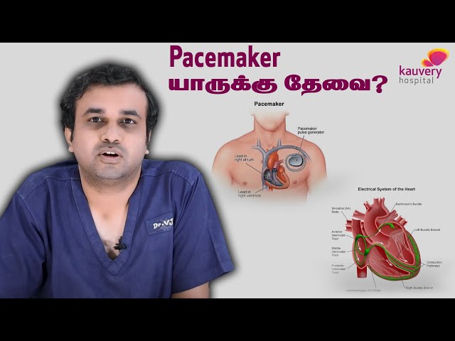 Who needs a Pacemaker | யாருக்கு இதயமுடுக்கி (பேஸ்மேக்கர்) தேவை?