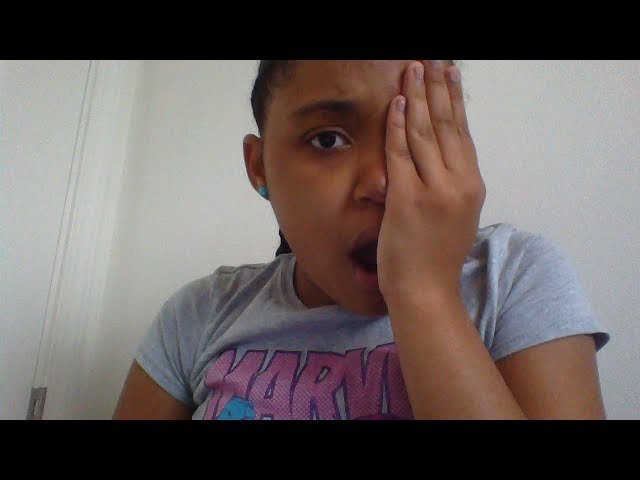 Black eye prank on sisters