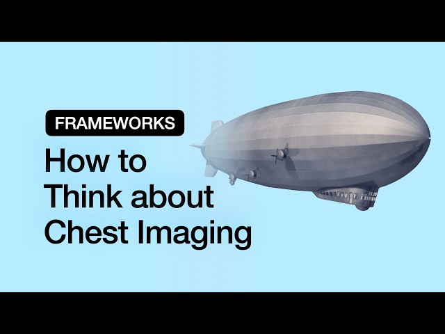 Chest Frameworks 0: Introduction (2026)