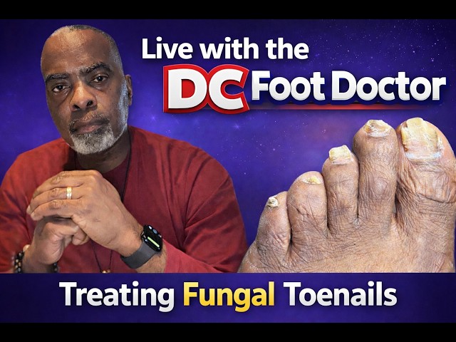 Treating Fungal Toenails