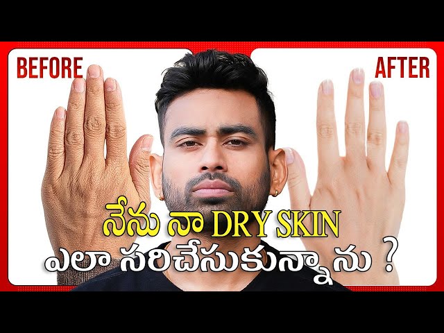 చర్మం పొడిబారడం   Dry Skin Permanent Solution   Fit Tuber Telugu