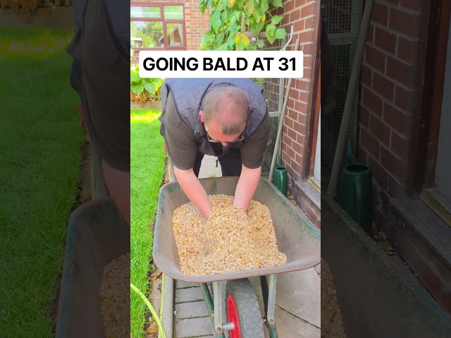 Going BALD at 31 #racingpigeons #pigeon101 #foryou #bald #hairstyle #hair