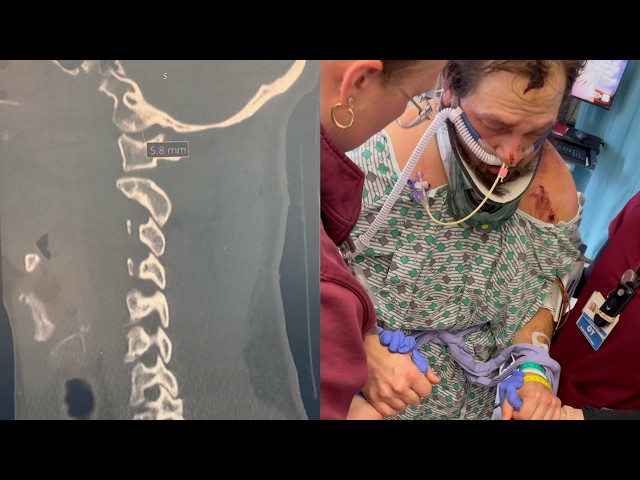 Ohio Dad Suffers Internal Decapitation During Work Accident