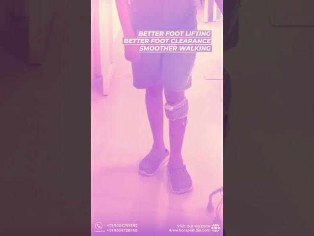From Foot Drop to Functional Gait | How FES Supports Walking