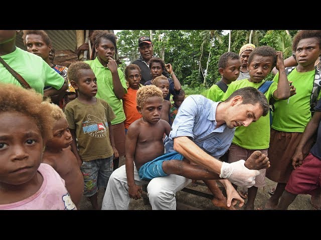 Reviving a 60-year quest to eradicate a disfiguring disease
