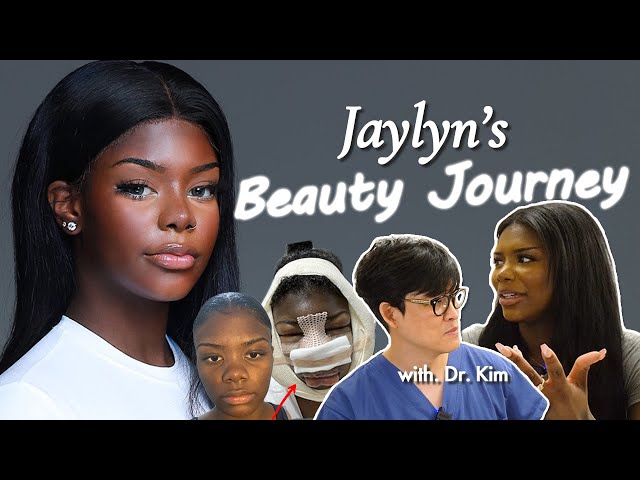 I Changed My Entire Face… (Full Plastic Surgery Journey)