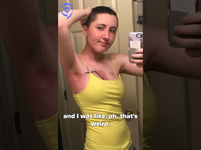 I Was Told I Was TOO YOUNG To Have BREAST CANCER!