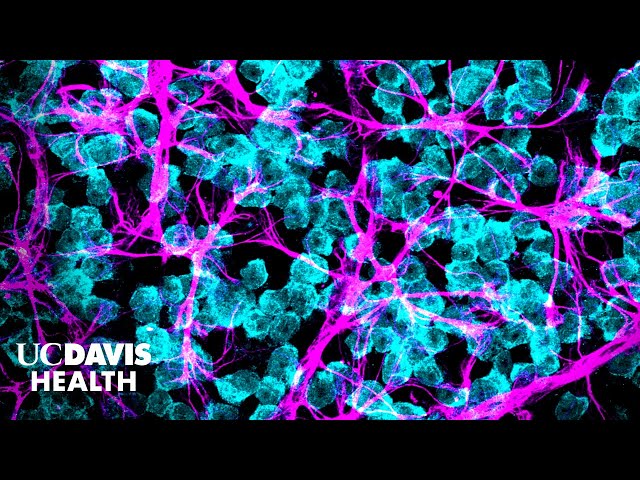 Explorando soluciones para la ceguera causada por glaucoma utilizando células madre