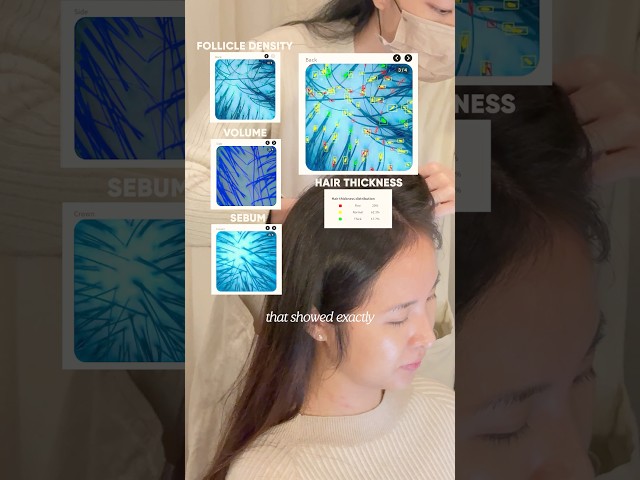 I got an in-depth scalp analysis… 😳