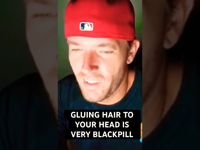 Goatis - Sv3rige Glues a wig to his head
