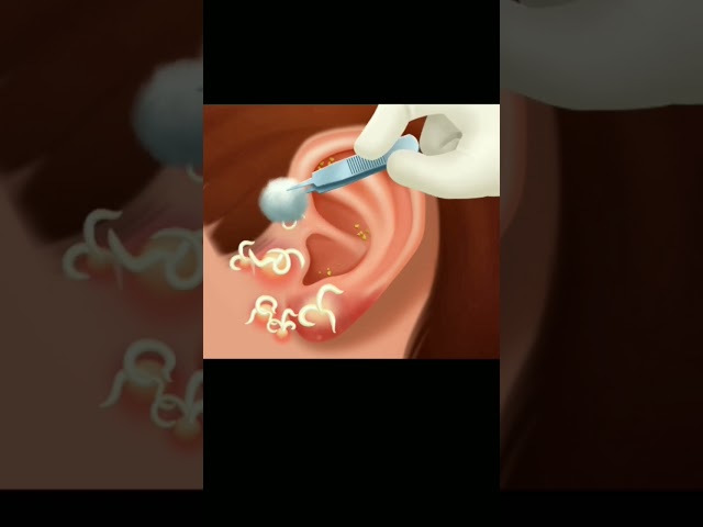 ear treatment 😮💥 #shorts #games #treatment #viral #asmr