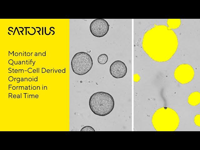How to Monitor Label-Free Confluence with AI Confluence Analysis with Incucyte® Proliferation Assays