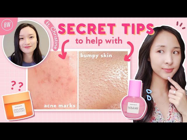 How to Improve Your Routine to Reduce Acne, Hyperpigmentation & Skin Texture ft. Glow Recipe