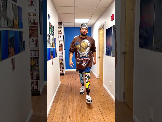 James Shows Strong Control on New Prosthetic Legs