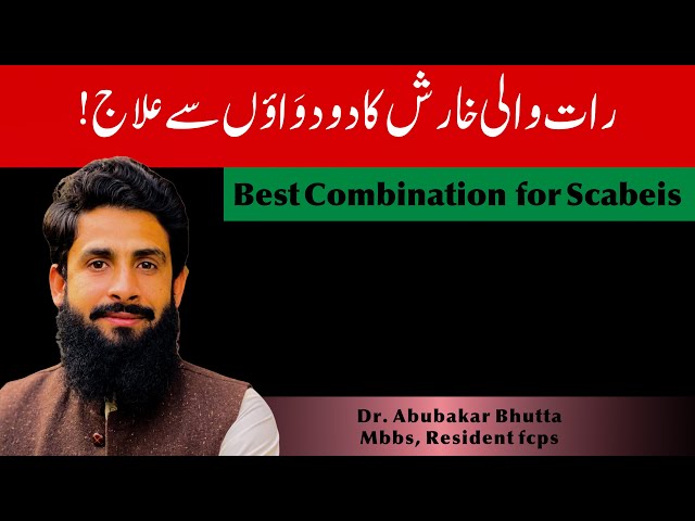 Night itch(Scabies) Best Treatment | kharish ka elaj | खारिश का इलाज