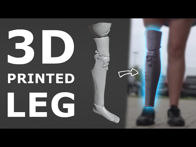 3D Printed Prosthetic Leg Cover