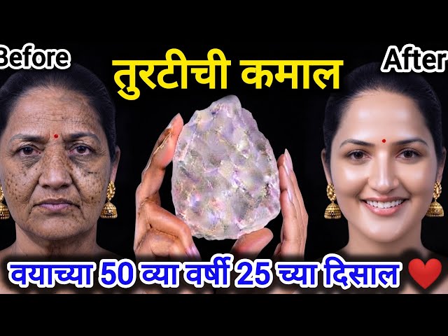वांग, काळे डाग, सुरकुत्या गायब झाले फक्त 2 दिवसात skin whitening tips vaang daag upay / alum / gore 