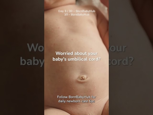 Day 3 of 30 Days ! Umbilical Cord Care Do's and Don'ts for New Parents