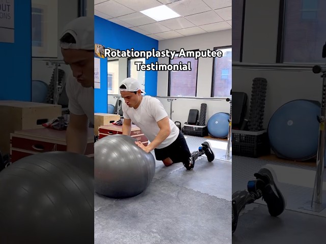 JP Learning to Walk with a Rotationplasty Prosthetic Leg for the 1st Time