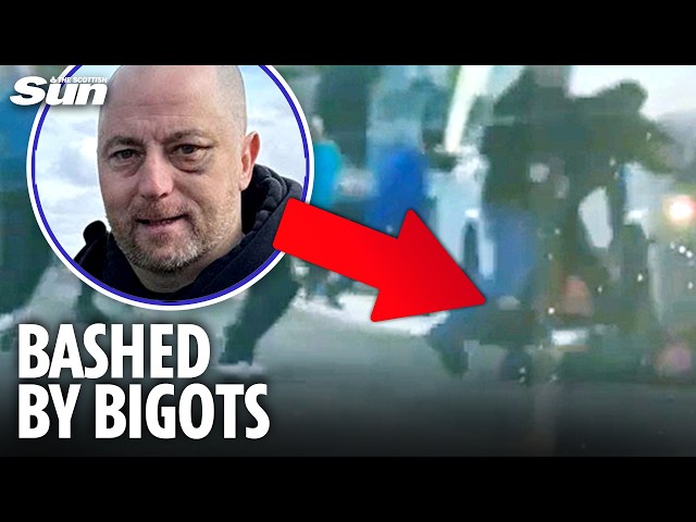 Twisted Rangers thugs nailed over Celtic fan's horror head injuries after shame game attack