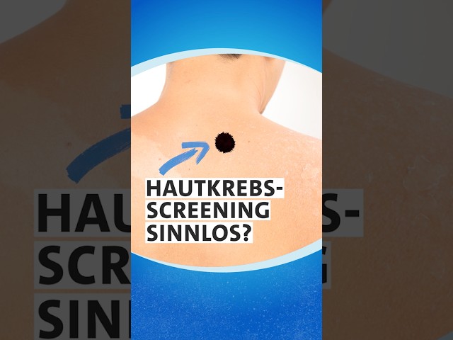 🔍👨‍⚕️ Darum bringt das Hautkrebs-Sreening nix! | Studio Q